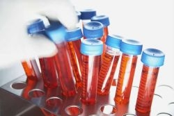 Антимюллеров гормон бесплодия