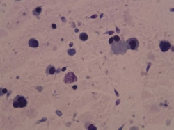 Гормоны при бесплодии у женщин